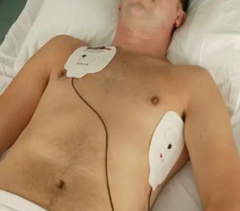 An image displaying where to place defibrillator pads on a patient in accord with the final D of DRSABCD.