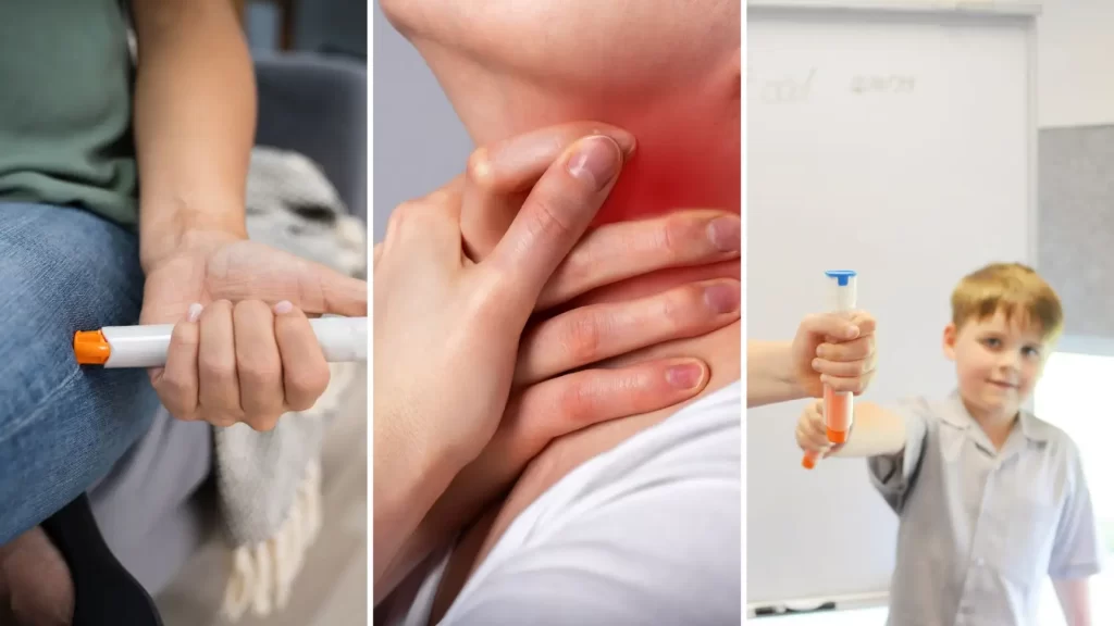 A collage showing how to treat anaphylaxis with an epi-pen, and an image of the symptoms of this condition.
