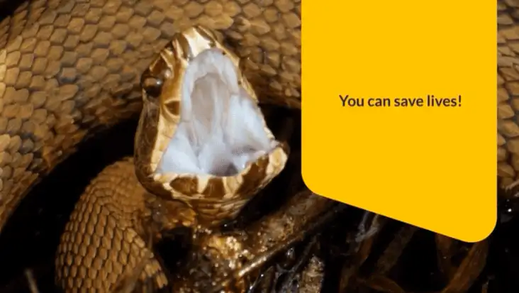 Snakebite? Here's The First Aid You Need To Know. - Accidental Health ...