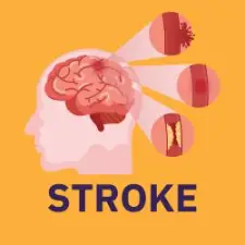 navigational button and isometric image of stroke