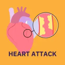 navigational button and isometric image of heart attack