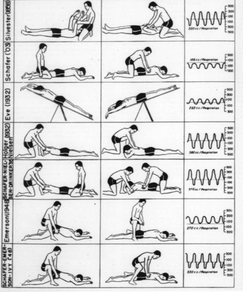 Some of the different artificial respiration techniques trialed in the early 20th Century